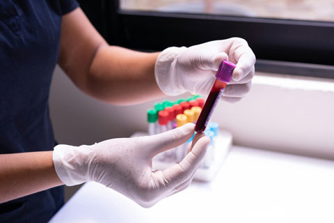 test tube