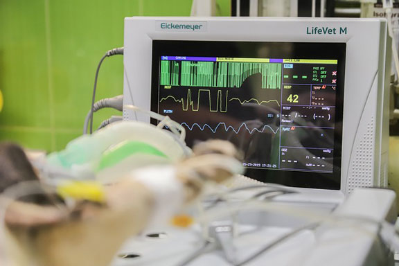 EKG